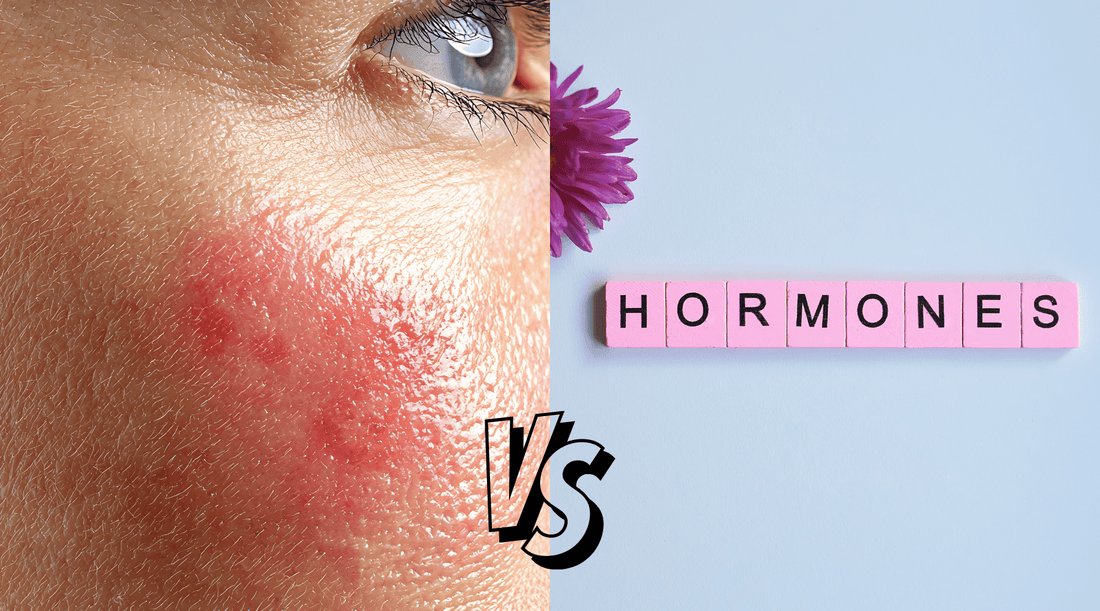 How Inflammation Affects Hormone Health